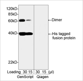 His Tag Antibody